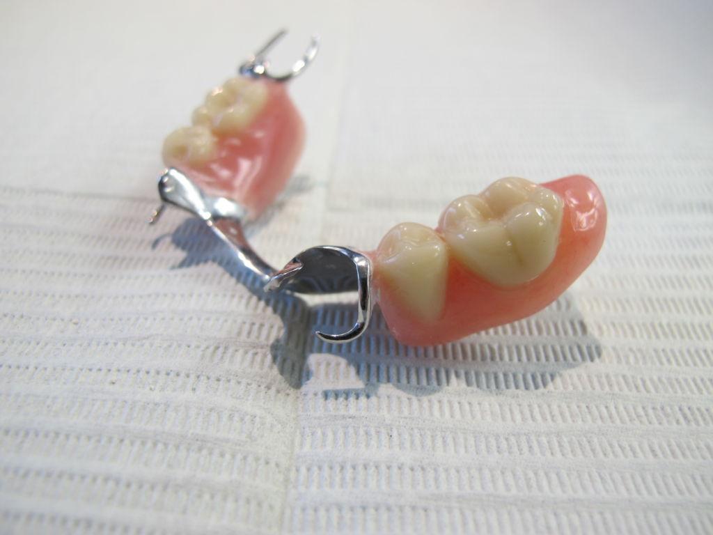 partial-dentures-in-windsor-baker-lanoue-denture-clinic