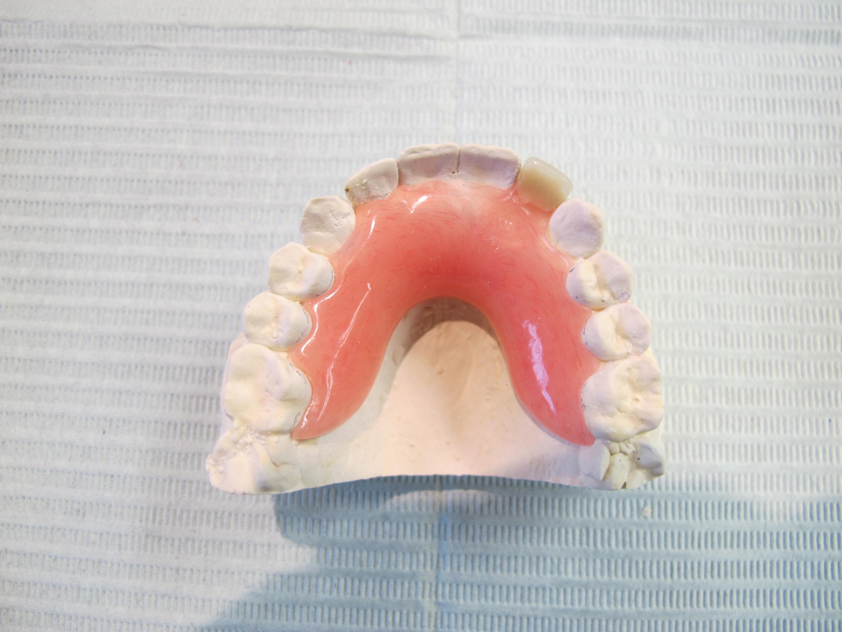 partial dentures in windsor