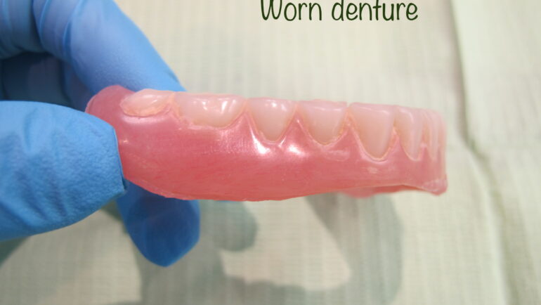 Do You Need New Dentures?